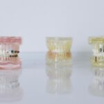 The Future of Orthodontics: Precision and Comfort with Praxis Brackets