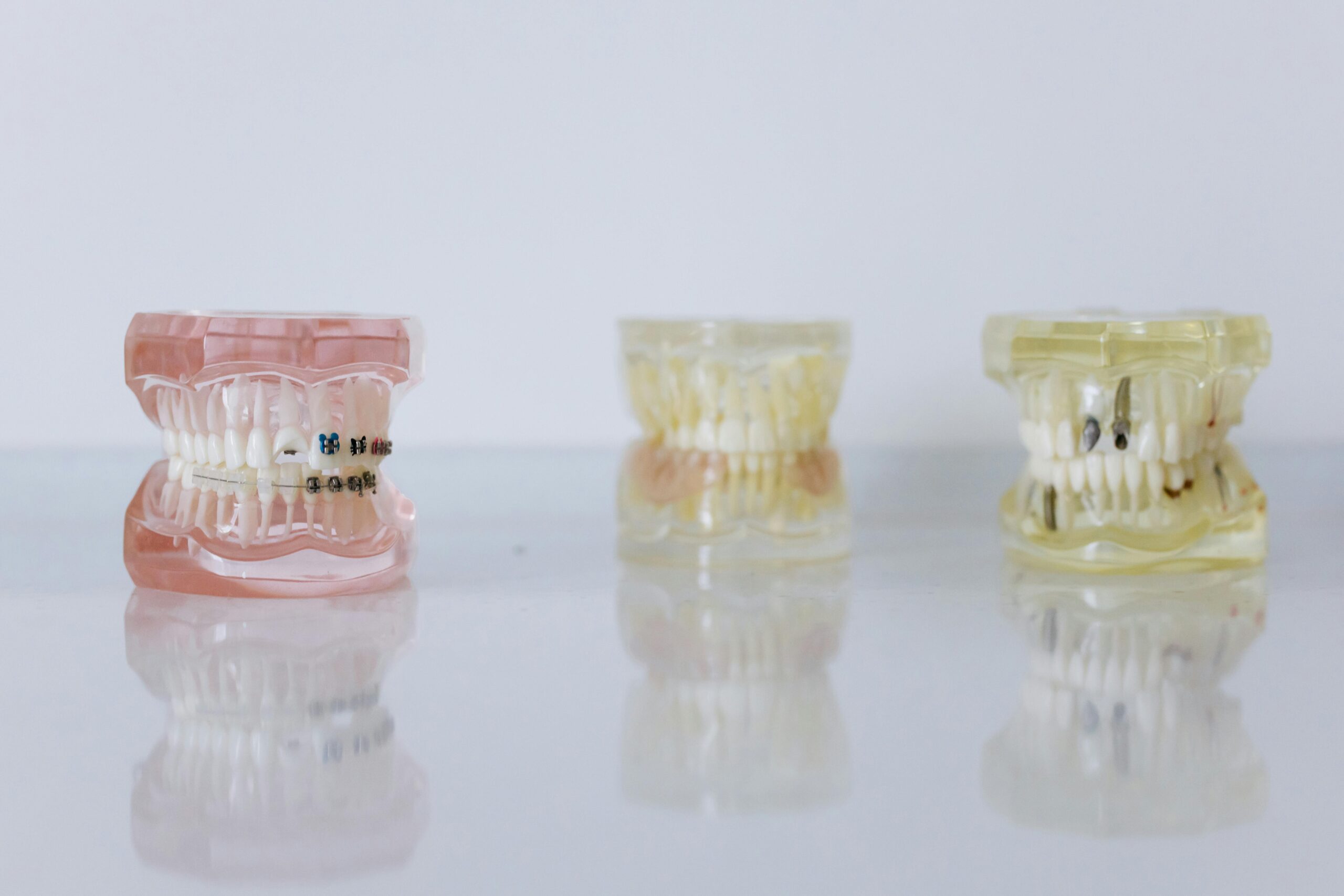 You are currently viewing The Future of Orthodontics: Precision and Comfort with Praxis Brackets